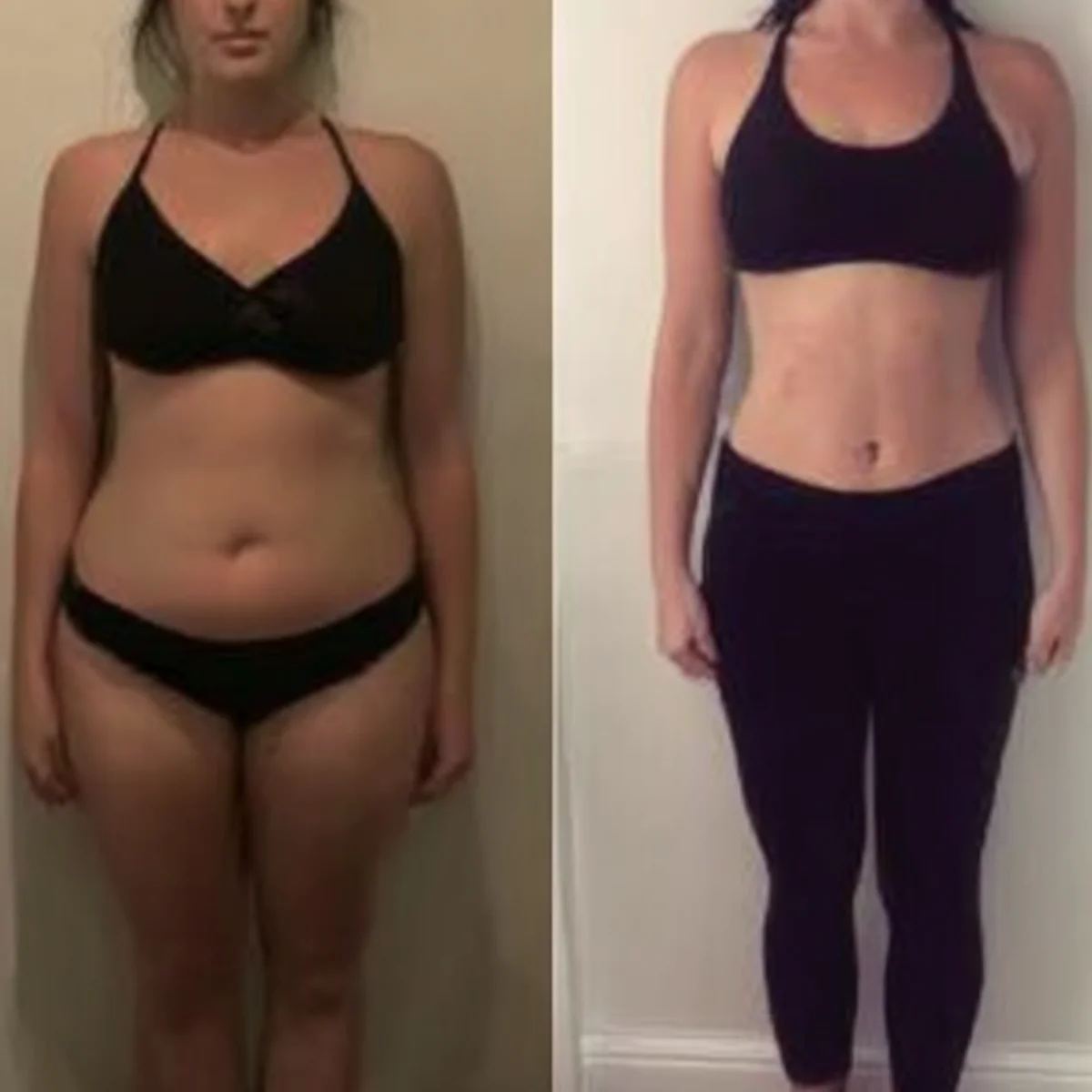 Sophie before after results Dubai transformation